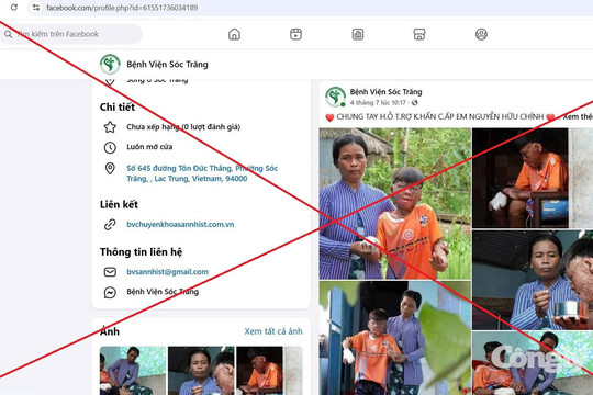 Giả mạo fanpage bệnh viện để kêu gọi từ thiện, trục lợi từ hoàn cảnh thiếu niên bị bỏng