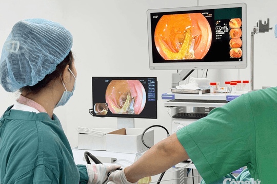 Túi ni lông dài 20 cm mắc trong ruột non người đàn ông
