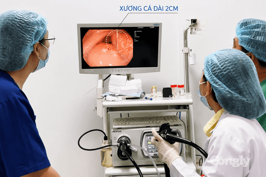 Gắp xương cá cắm sâu trong dạ dày bệnh nhân 70 tuổi