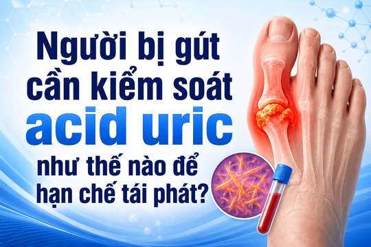 Người bị gút cần kiểm soát acid uric như thế nào để hạn chế tái phát?