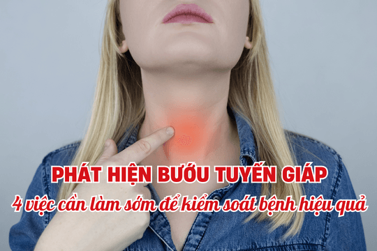 Phát hiện bướu tuyến giáp: 4 việc cần làm sớm để kiểm soát bệnh hiệu quả