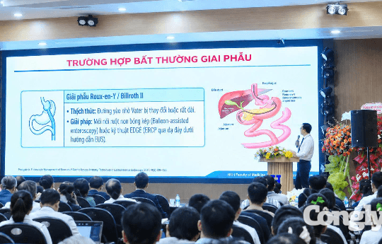 Phát hiện ung thư sớm đến can thiệp ít xâm lấn nhờ nội soi