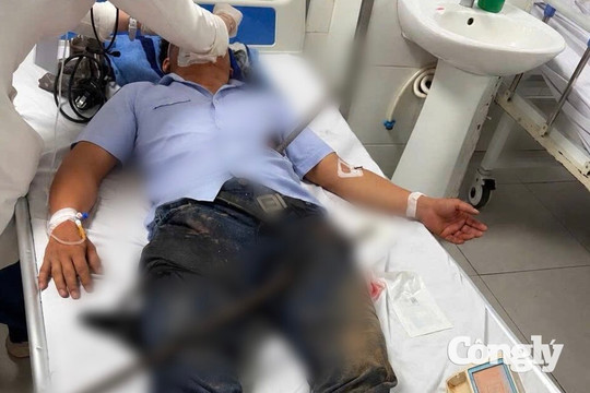 Cứu sống bệnh nhân bị hai thanh sắt xuyên qua người