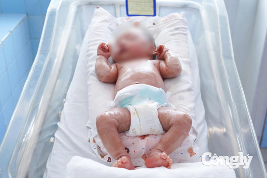 Bé sinh non mắc vảy cá hiếm gặp