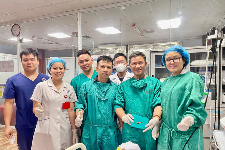 Gắp dị vật dài hơn 6cm trong đường thở cho bệnh nhân tại Thái Nguyên