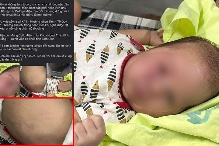 Công an vào cuộc xác minh vụ việc cha đánh con 3 tháng tuổi nhập viện