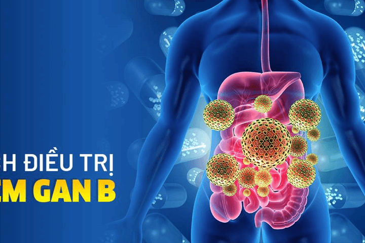 Việt Nam: Khoảng 6,5 triệu người nhiễm viêm gan B