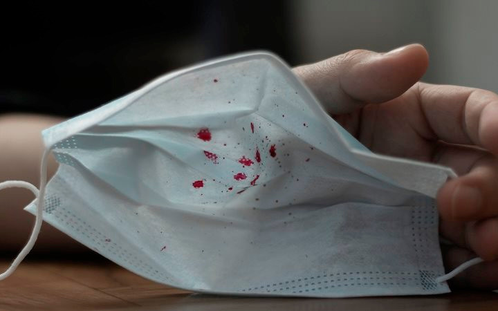 Xuất hiện virus bí ẩn gây bệnh nặng, ho ra máu ở Nga