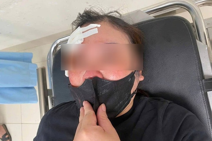 Triệu tập người ngồi trên xe bán tải dùng dùi cui vụt vào đầu người đi đường