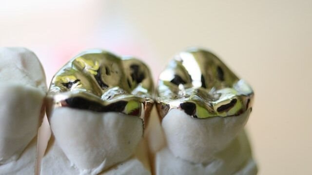 Người đàn ông thu gom răng vàng của người chết, nấu được thỏi vàng 1.800 USD