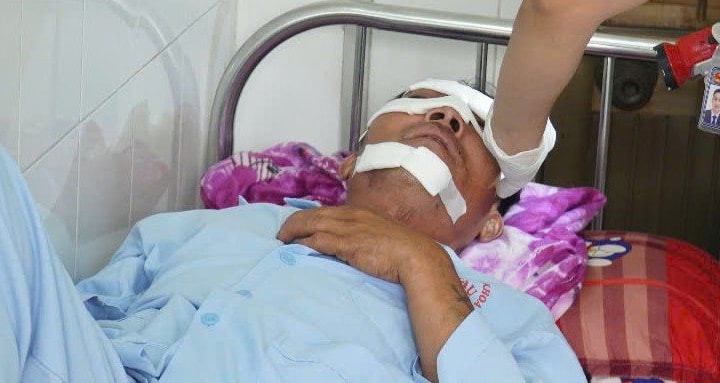 Người đàn ông bị cánh quạt máy bay không người lái chém trọng thương