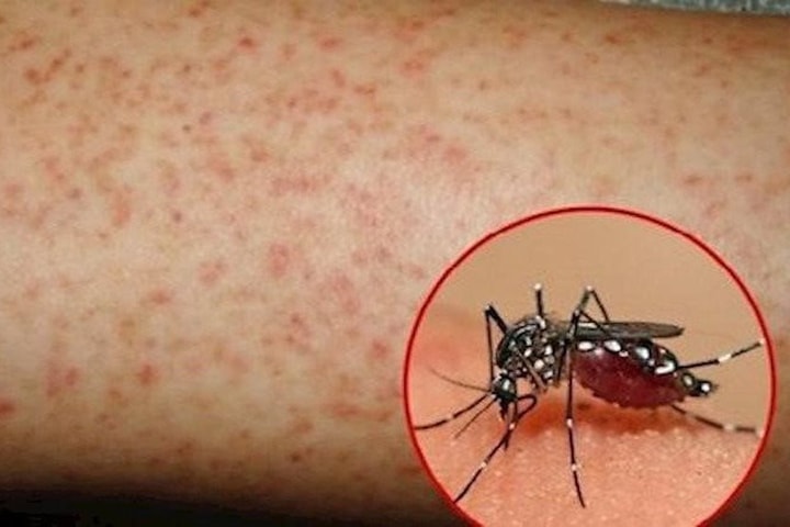 Tăng cường phòng, chống dịch sốt xuất huyết