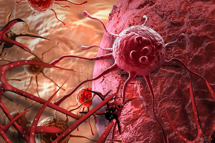 Phát hiện mới trong phương pháp điều trị ung thư