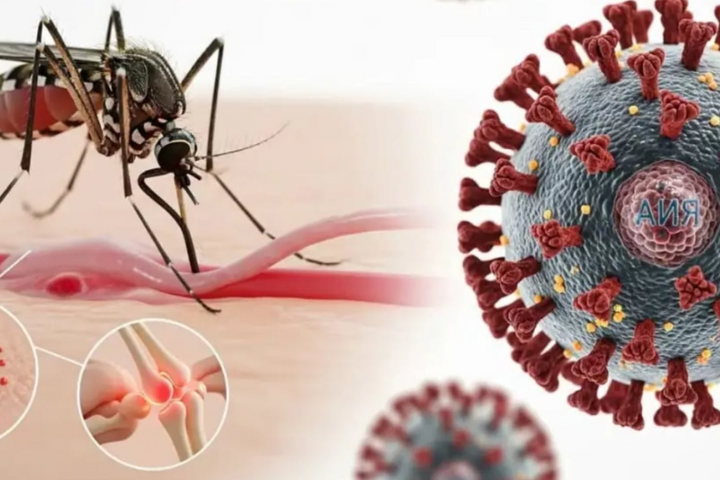 Bộ Y tế bác tin đồn Việt Nam có ca mắc Chikungunya