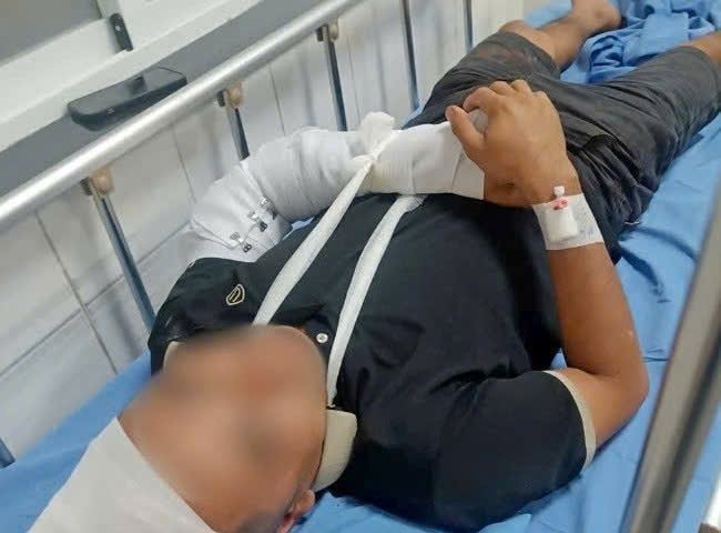 Điều tra vụ việc tài xế xe cứu hộ giao thông bị đánh gãy tay