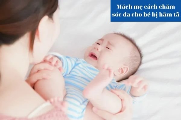 Mách mẹ cách chăm sóc da cho bé bị hăm tã