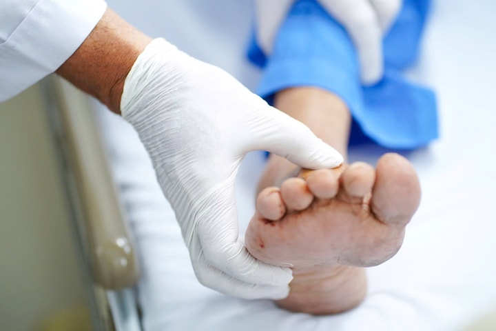 Gắp thành công dị vật trong mu bàn chân của thầy giáo