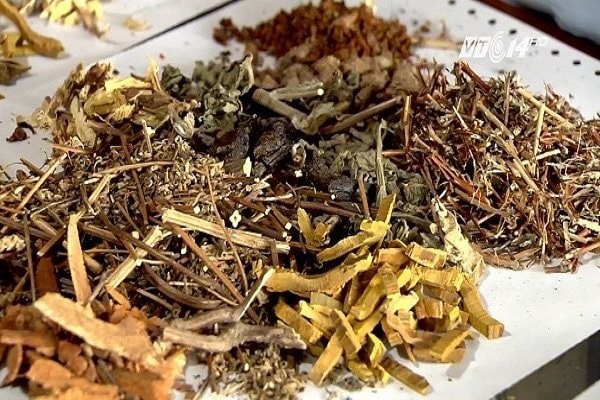 Suy gan cấp sau 10 ngày liên tục uống thuốc nam chữa đau đầu