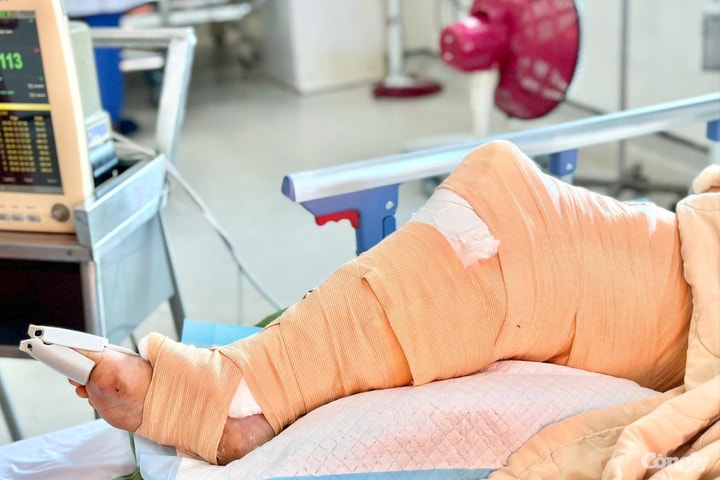 Cấp cứu kịp thời, giữ lại cẳng chân cho cháu bé sau tai nạn giao thông