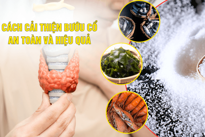 Cách cải thiện bướu cổ đơn thuần an toàn và hiệu quả