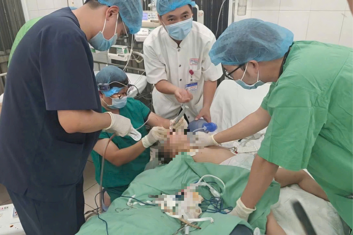 Cứu sống bé gái 3 tuổi mắc dị vật đường thở nguy kịch trong dịp Tết