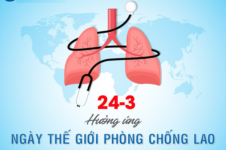 Khám sức khỏe định kỳ - “cửa ngõ” phát hiện sớm bệnh lao
