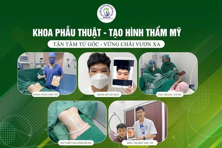Ứng dụng phẫu thuật cắt tuyến mồ hôi nách hiệu quả tại Khoa Phẫu thuật Tạo hình Thẩm mỹ