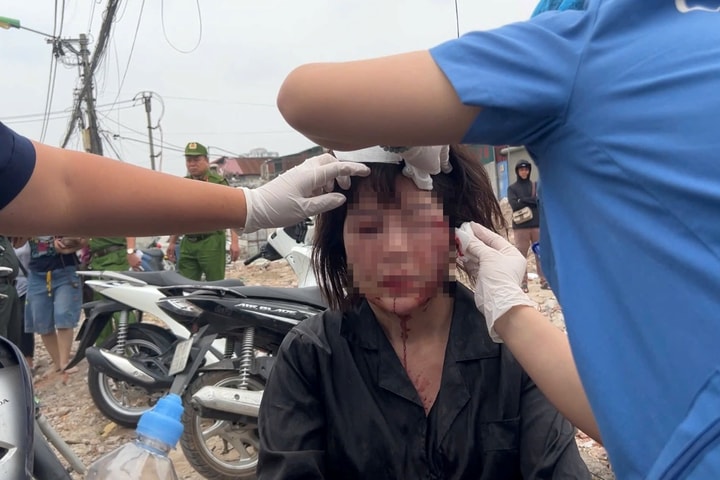 Xô xát trên đường Tam Trinh, một phụ nữ nhập viện cấp cứu