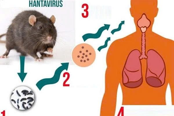Hantavirus và căn bệnh khiến du khách trên tàu du lịch Đại Tây Dương tử vong là gì?