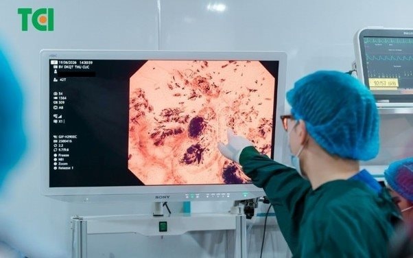 Vì người Việt và hành trình đưa Endocyto 520x về nước của Thu Cúc TCI