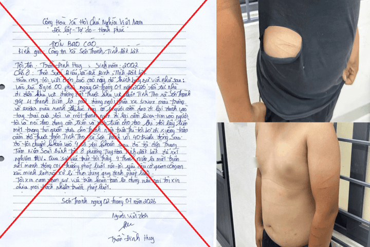 Dựng chuyện bị cướp 40 triệu đồng, thanh niên bị phạt