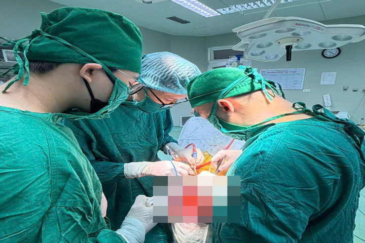Phẫu thuật khối u não lớn cho người phụ nữ 73 tuổi
