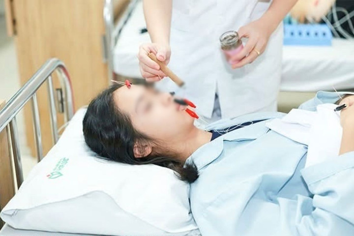 Nữ sinh bị lệch mặt do thói quen nhiều người mắc phải
