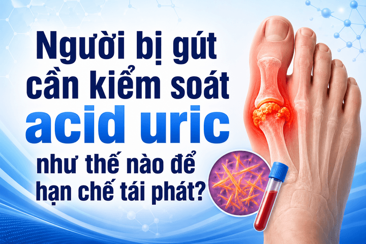 Người bị gút cần kiểm soát acid uric như thế nào để hạn chế tái phát?