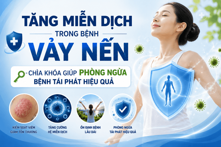 Tăng miễn dịch trong bệnh vảy nến - Chìa khóa giúp phòng ngừa bệnh tái phát hiệu quả