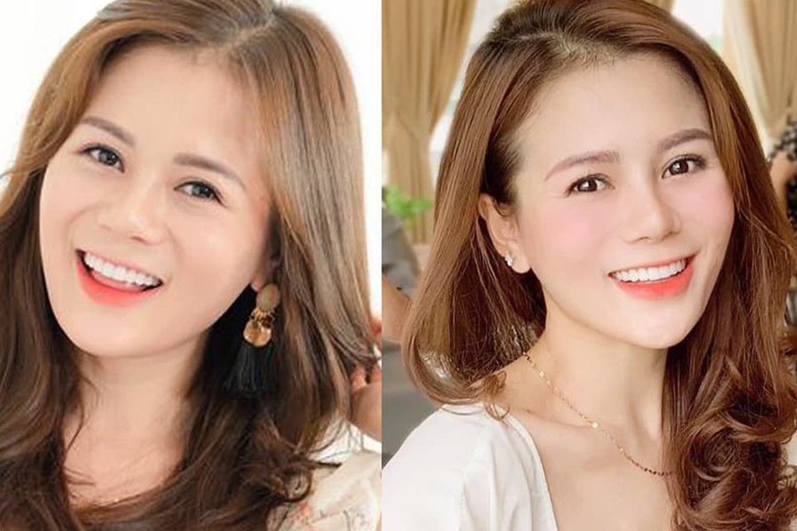 Bí kíp nâng cơ, trẻ hóa da không cần phẫu thuật