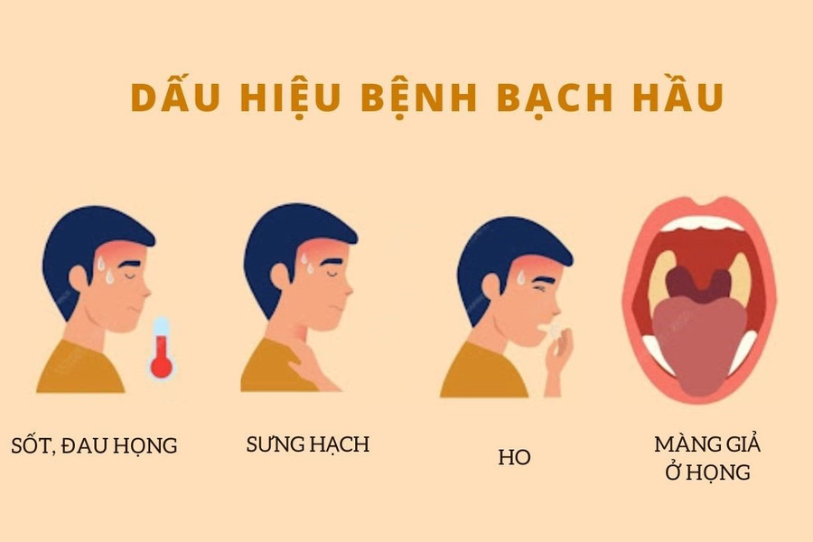 Bệnh bạch hầu ở nước ta vẫn trong tầm kiểm soát