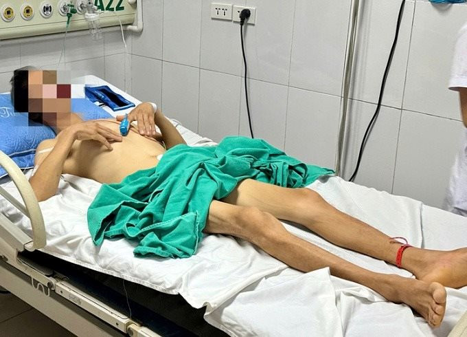 Ngỡ đã từ trần vì thanh lọc cơ thể
