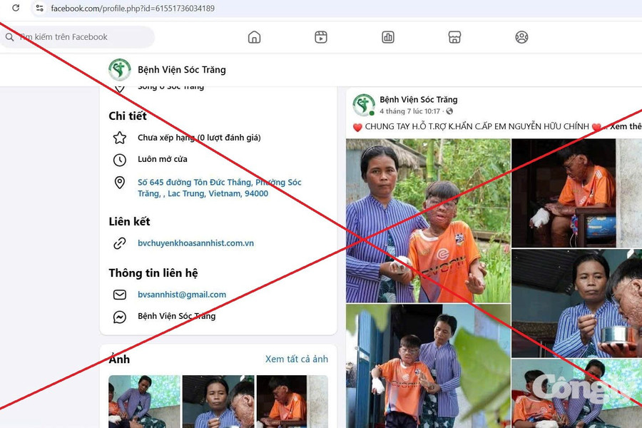 Giả mạo fanpage bệnh viện để kêu gọi từ thiện, trục lợi từ hoàn cảnh thiếu niên bị bỏng