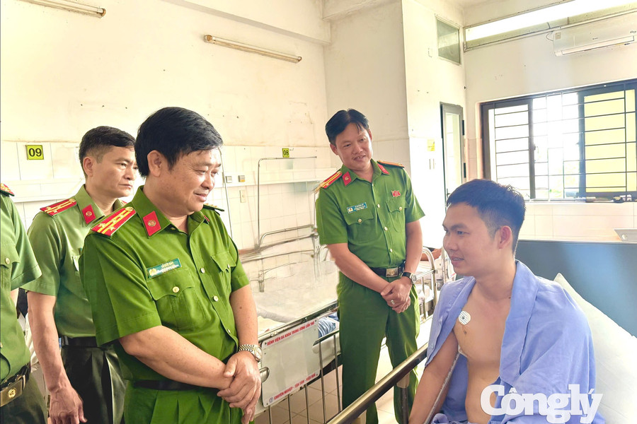 Thăm hỏi cán bộ công an bị thương khi làm nhiệm vụ