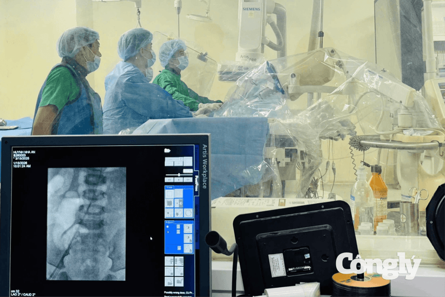Can thiệp thành công 11 ca tim bẩm sinh phức tạp