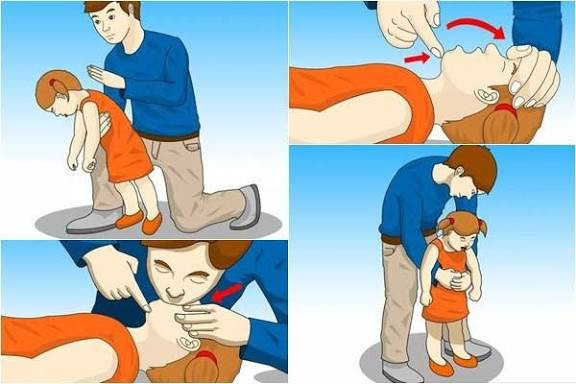 Dấu hiệu nhận biết trẻ bị hóc dị vật